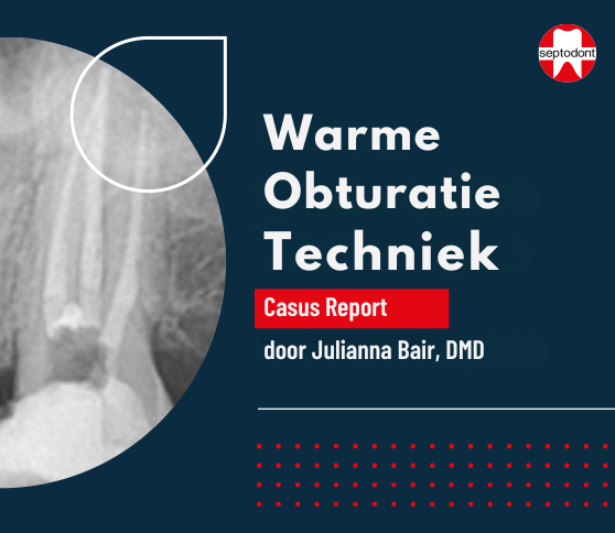 BioRoot Flow - Pediatrische & warme obturatie casuïstiek door Dr Julianna Bair tandarts